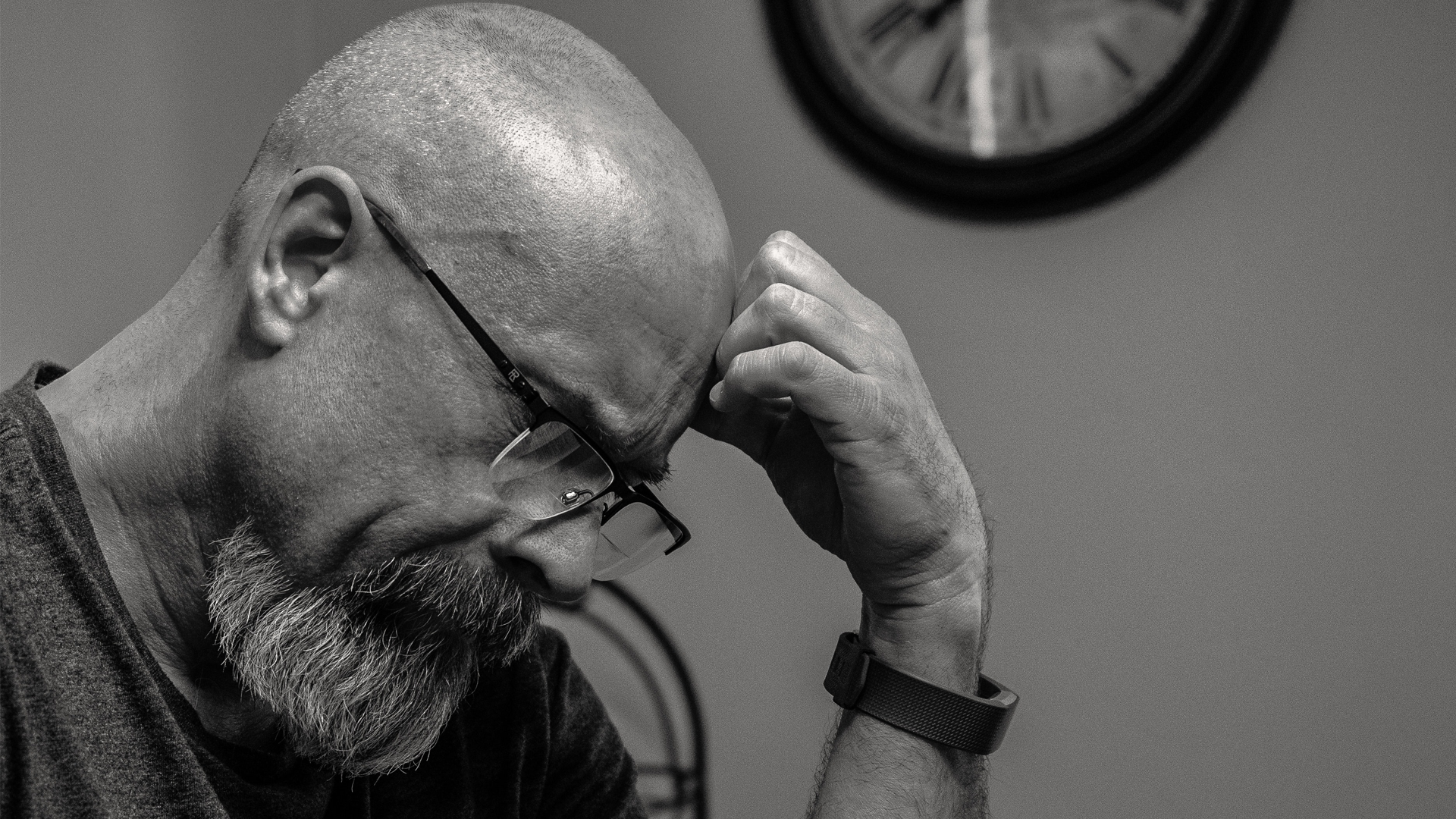 Balding white man shaves head, grows beard to retain “youthful” look